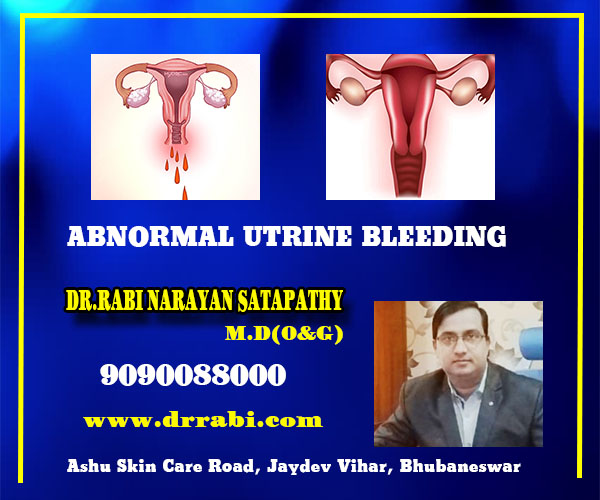 best abnormal utrine bleeding treatment clinic in bhubaneswar, odisha